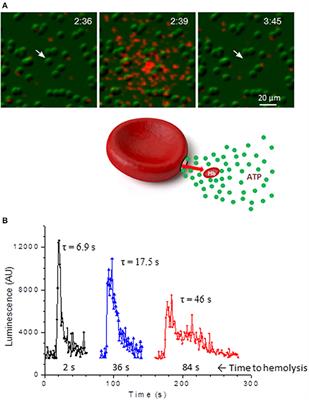 Effects of Hypoxia on Erythrocyte Membrane Properties—Implications for Intravascular Hemolysis and Purinergic Control of Blood Flow